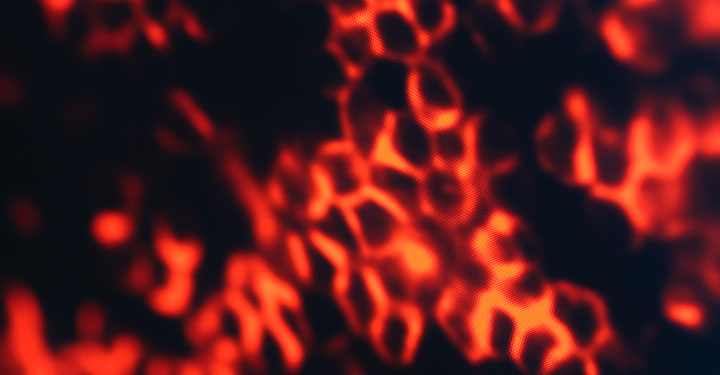 Photo of digital image of cells