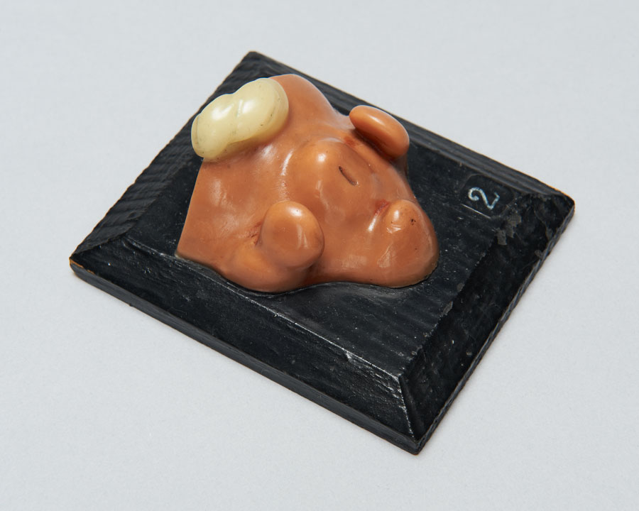 Wax model of the external genital organs of the human embryo- non- gendered