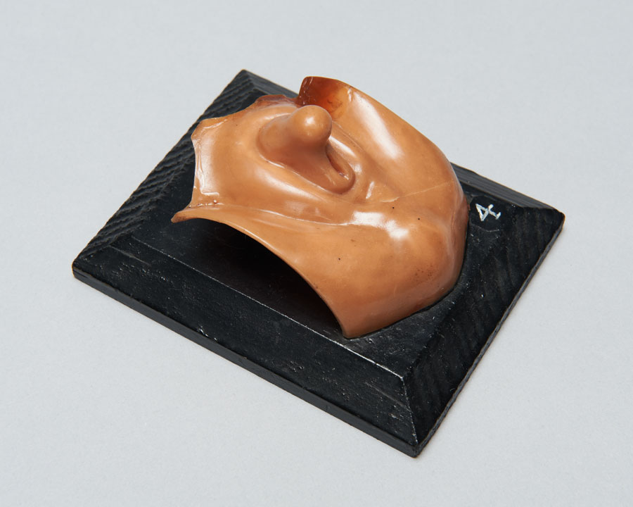 Wax model of the external genital organs of the human embryo- non- gendered
