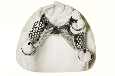 3d printed dental structure