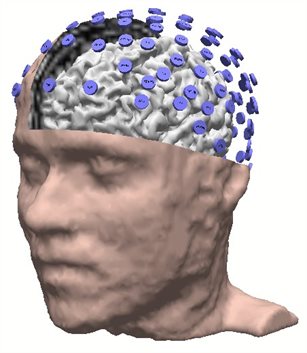 eeg-curry-electrodes-front-crop