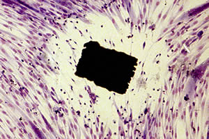 tox-metal-toxicity-stained