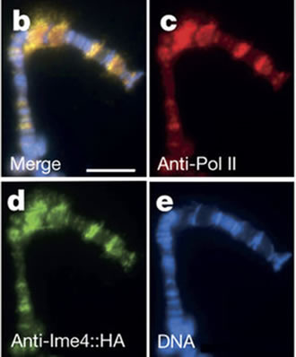 drosophila-polytene-chromosomes