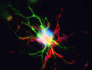 ms-neuron
