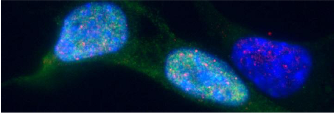 Microscopy image showing DNA-binding proteins inside cell nuclei