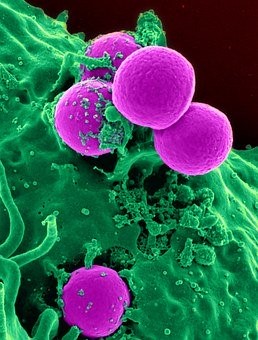 Birmingham scientists 're-train' immune system to prevent attack of healthy  cells in new UK study into autoimmune diseases - University of Birmingham