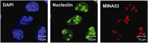 Oxygenases and cancer