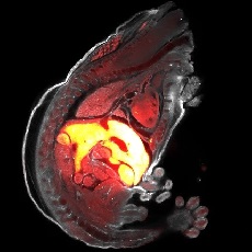 Cleared mouse embryo showing developing organs