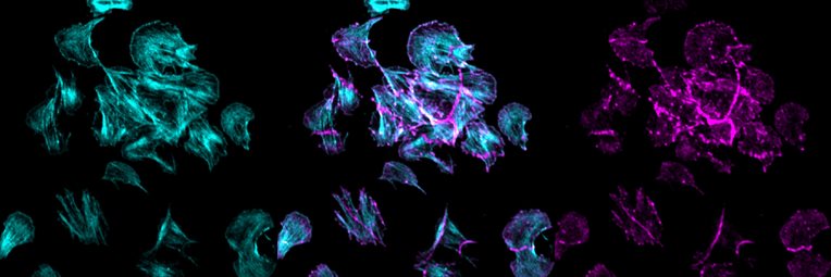Human platelets spread on collagen, labelled for the collagen receptor GPVI (magenta) and the actin cytoskeleton (cyan)