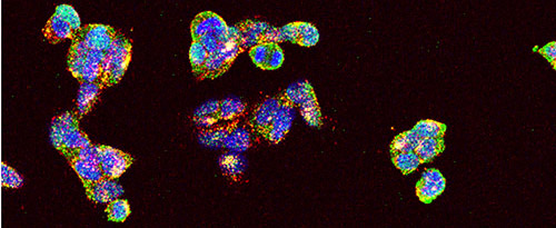 Leadbeater-stemm-cells-picture-v2