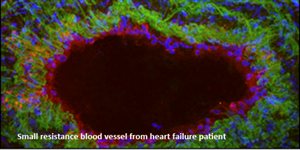 Small resistance blood vessel from heart failure patient