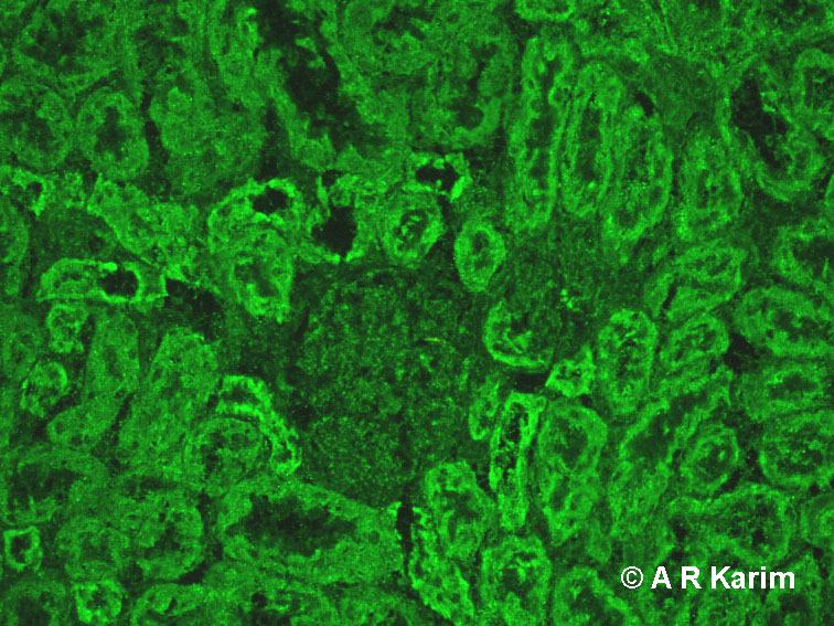 Diagram Of Kidney Tubules