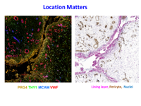 Location Matters. Right: PRG4, THY, MCAM, VWF. Left: Lining layer, Pericyte, Nuclei