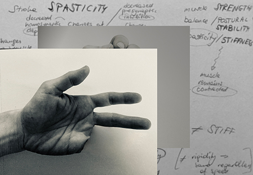 A picture of a hand with three fingers, on top of a page of notes.