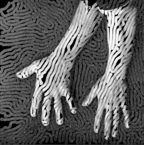 Digital image of two hands side by side showing an enlarged hand and normal hand with swirl patterns