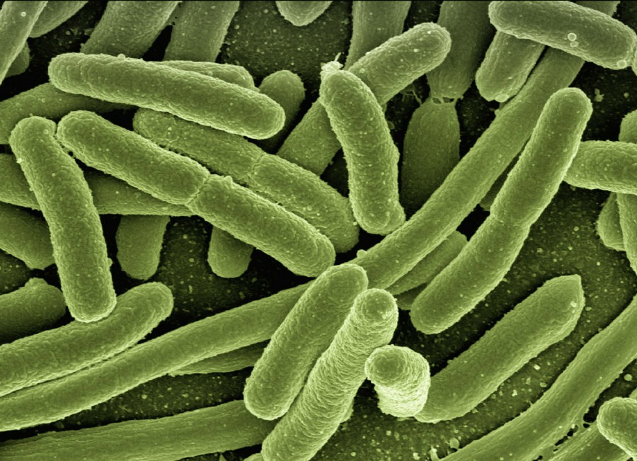 E-coli bacteria_900