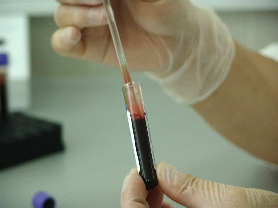 blood-sample-900px-v1