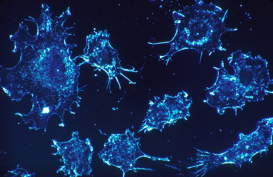 Blue tinted cancer cells on a microscope slide