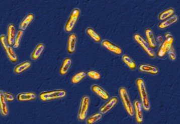 Clostridium difficile infection list image