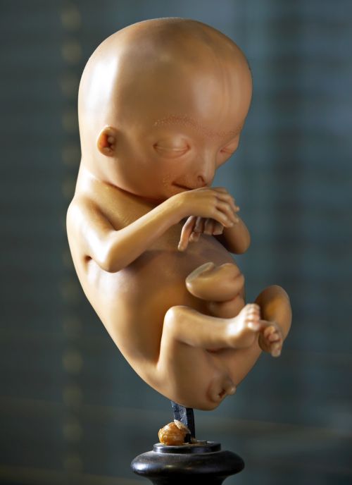 Foetus model, Friedrich Ziegler, Medical and Dental Collection