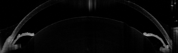 Anterior segment OCT imaging of the rat eye.