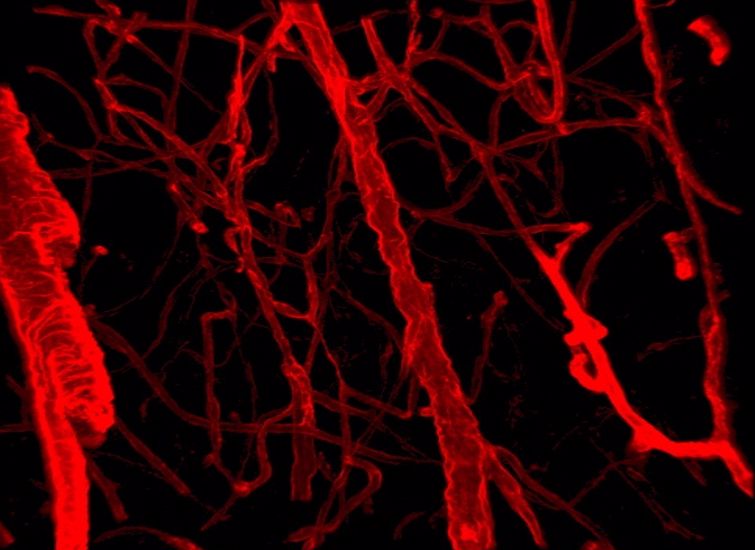 Confocal microscope image of the brain with laminin (red) in the basement membrane of cerebral blood vessels in organotypic brain slices