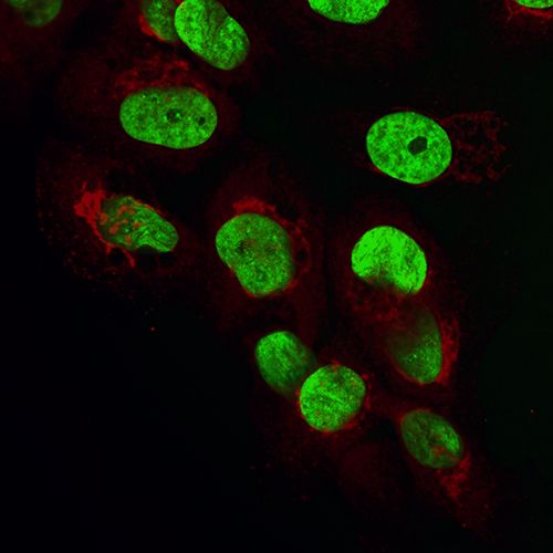 Fluorescence microscopic image of oral epithelial cells producing CXCL8 (red) in response to challenge by the periodontal pathogen F. nucleatum