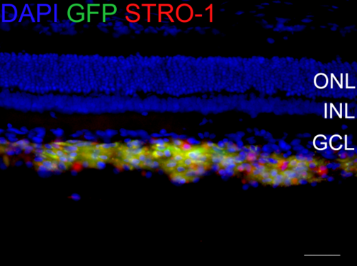 Localisation of GFP-transfected DPSC within the vitreous body of the eye following cell transplantation.