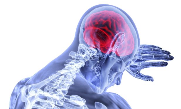 Digital image showing pressure in the brain.
