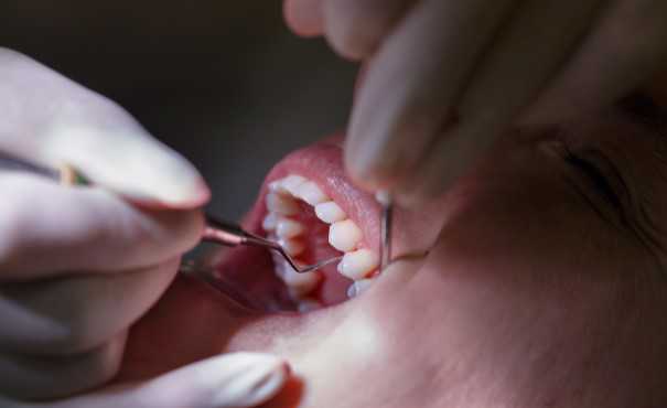 Dental hygienist inspecting a patient's teeth