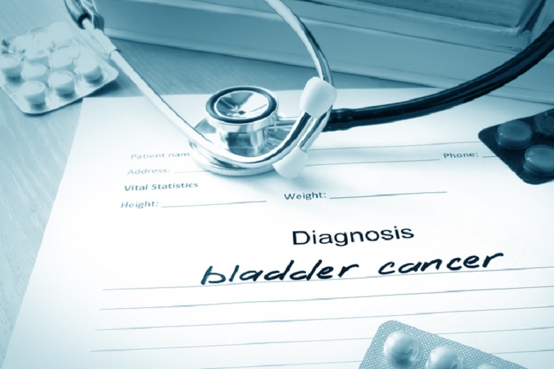 Doctors notepad, writing says diagnosis: bladder cancer 