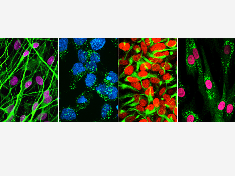 Four-panel image showing: neurons derived from hESCs labeled with MAP2; LC3‑positive autophagosomes appearing in hESCs after starvation-induced autophagy; hESC-derived neural precursors expressing Nestin and Pax6; and disease fibroblasts displaying p62 aggregates due to impaired autophagy.