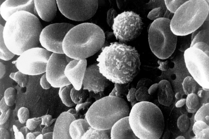 Black and white image of blood cells