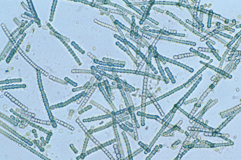 Microscope image of blue-green algae