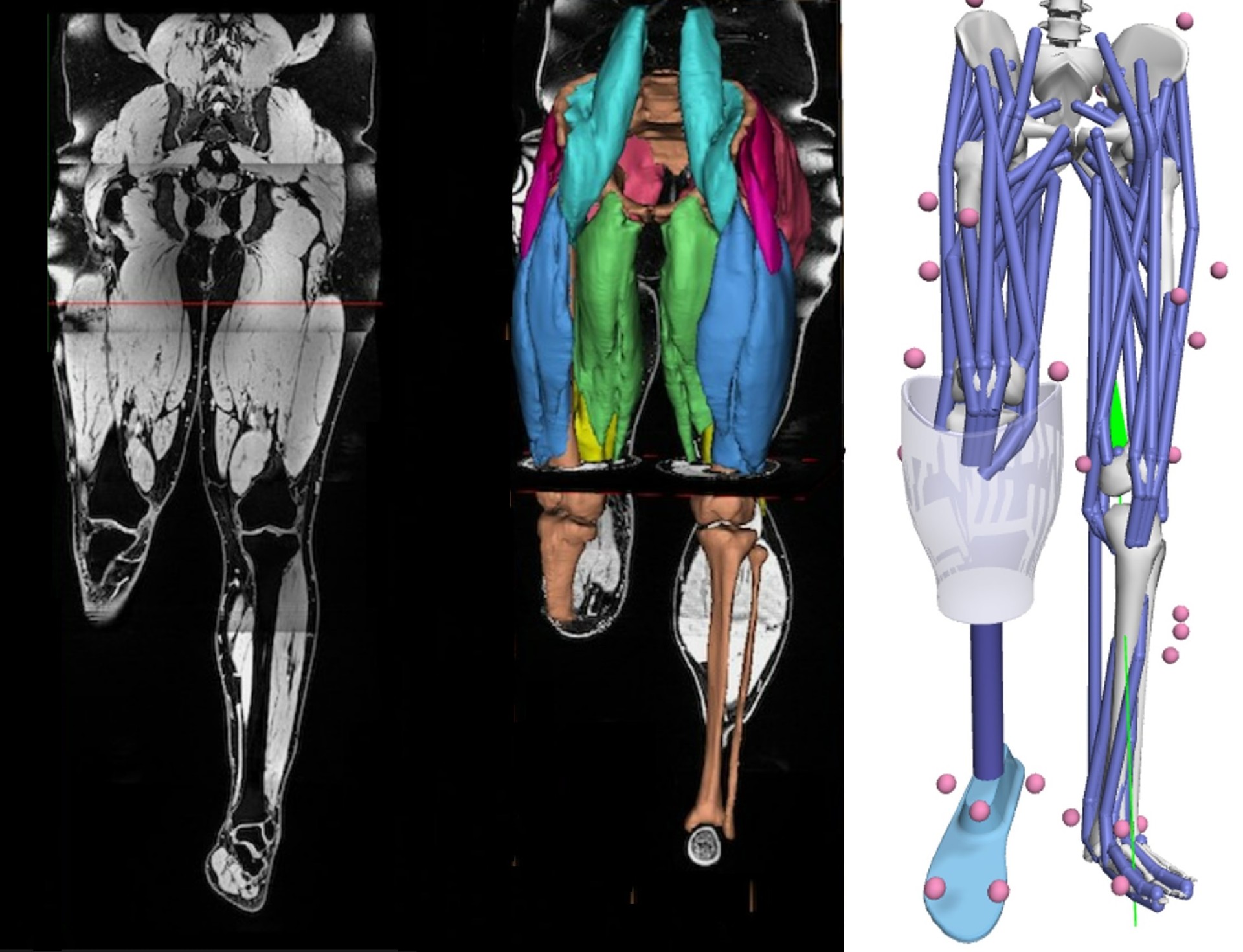 Computer images of leg muscles