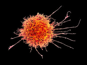 Colourised scanning electron micrograph of a natural killer cell from a human donor.