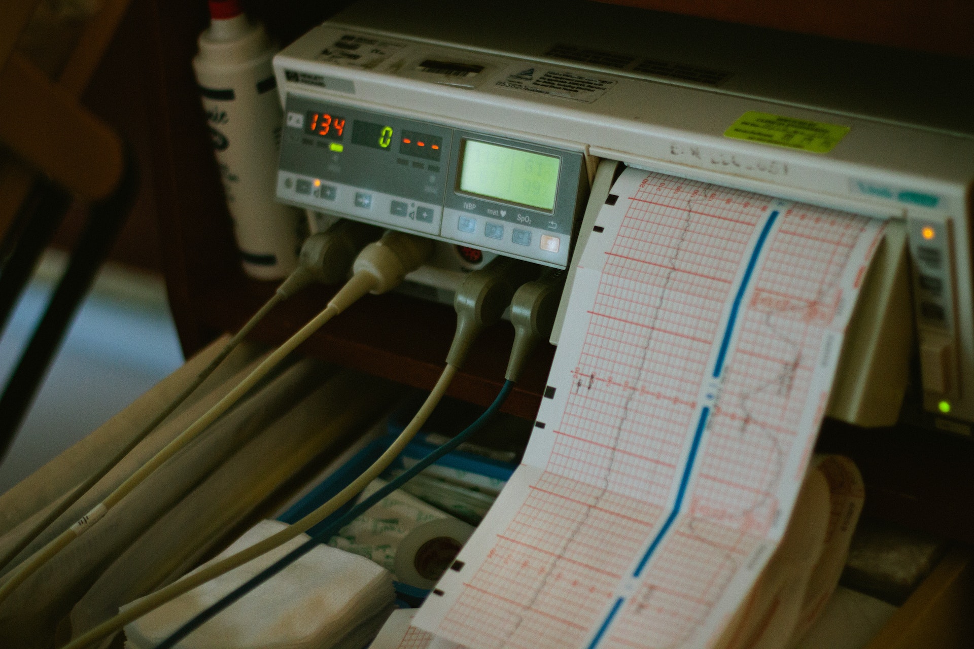 An ECG machine read out