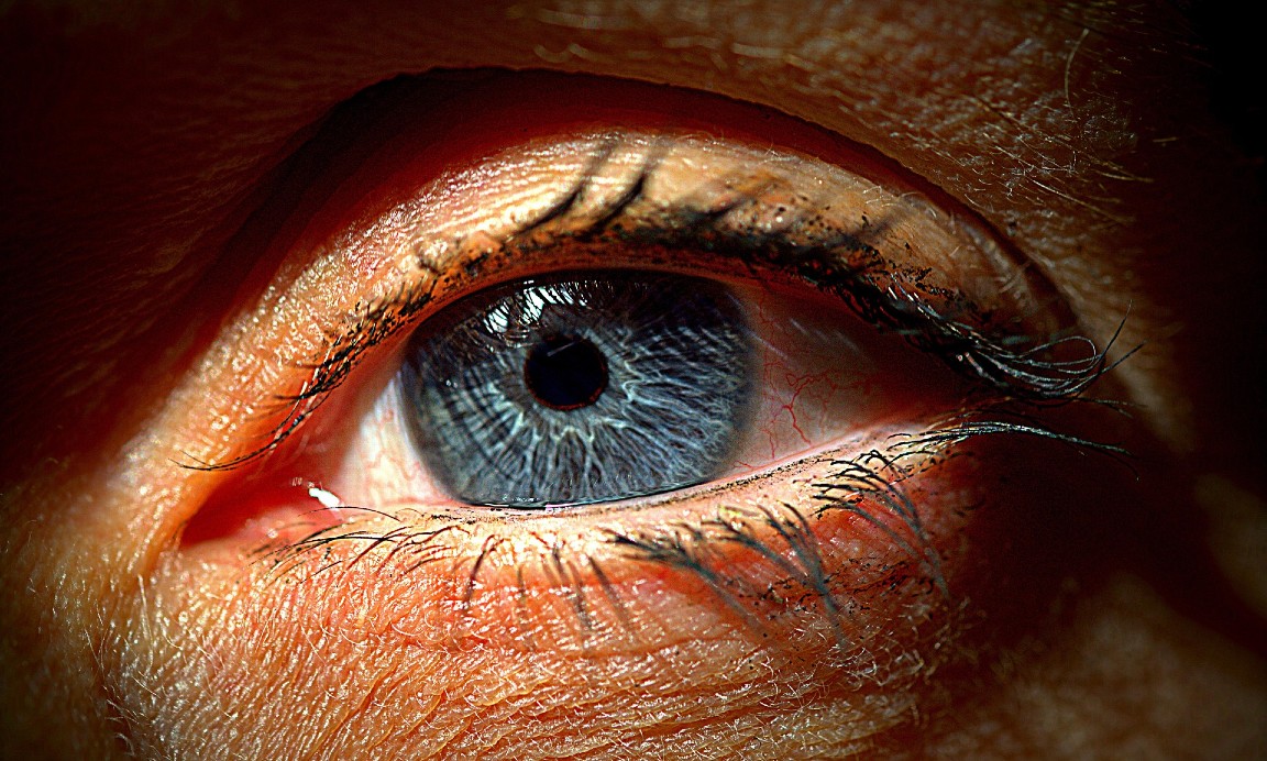 A close up of a sore-looking eye