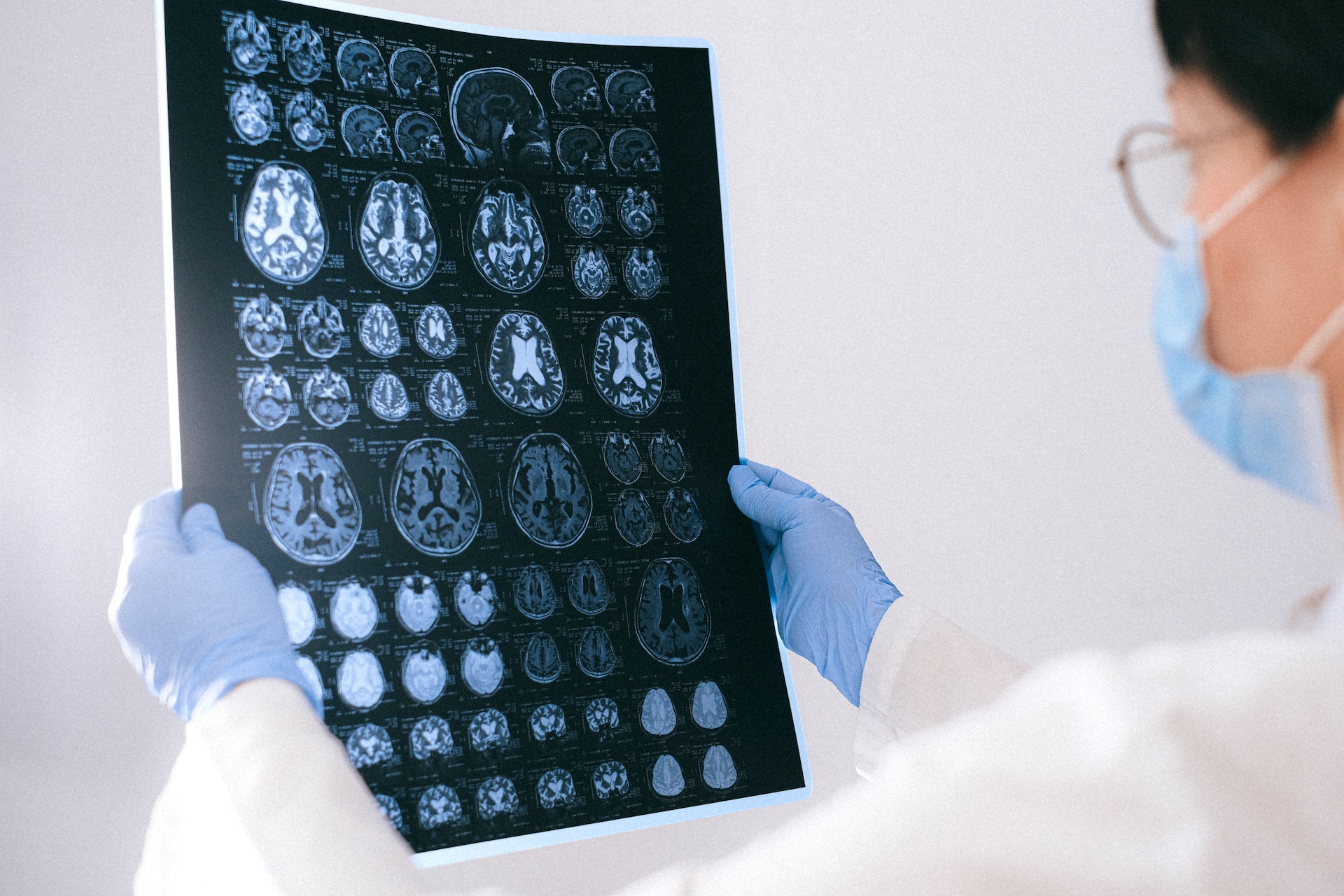 A doctor holding up a sheet of fMRI scan results from a brain