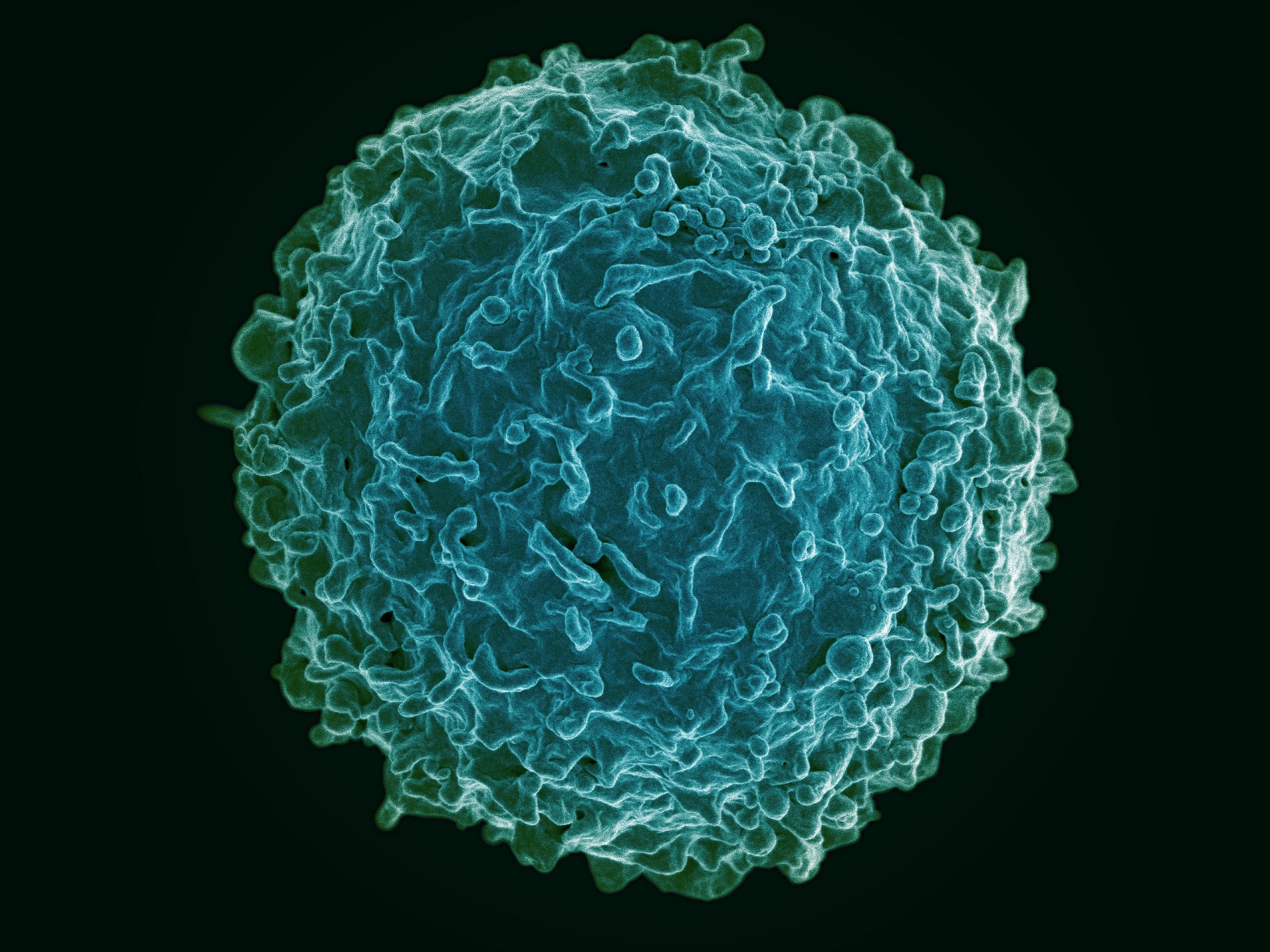 Colorized scanned close up image of a B cell from a human donor
