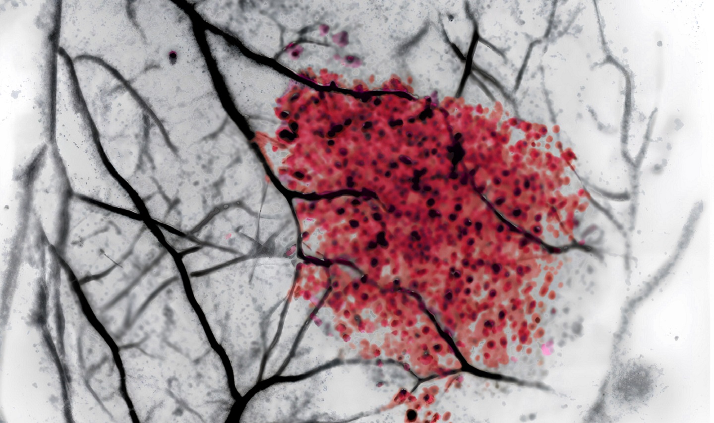 Microplastics in mammalian tissue