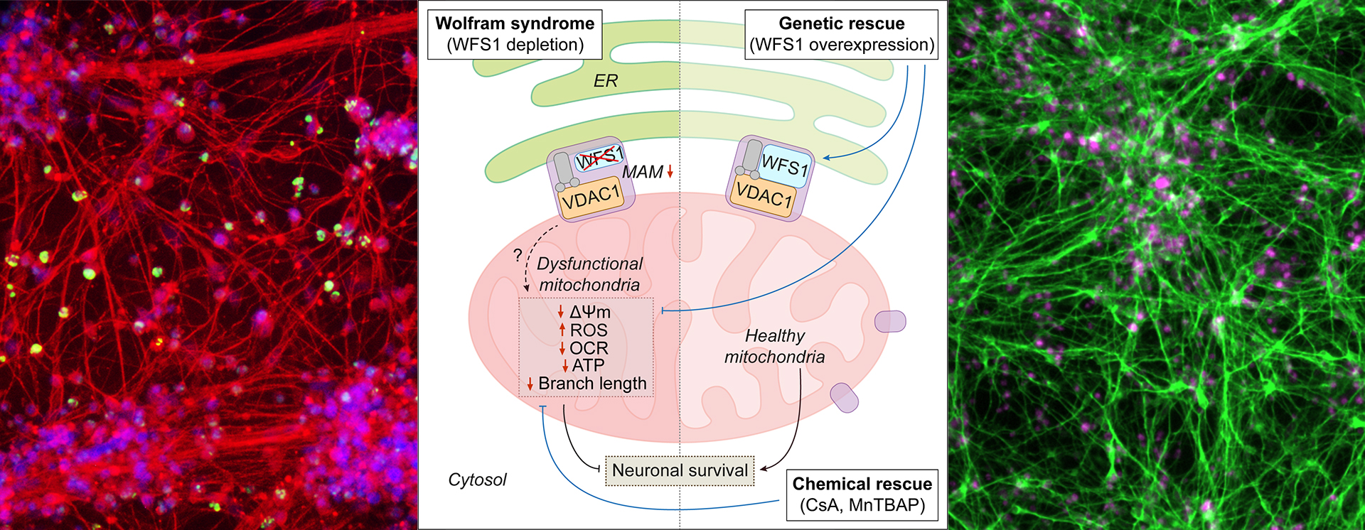 Microscopy images of disease-affected neurons generated from Wolfram syndrome patient-derived induced pluripotent stem cells, showing neuronal and cell death markers (left and right panels); Schematic representation of genetic and chemical rescue of mitochondrial dysfunction in Wolfram syndrome (middle panel).