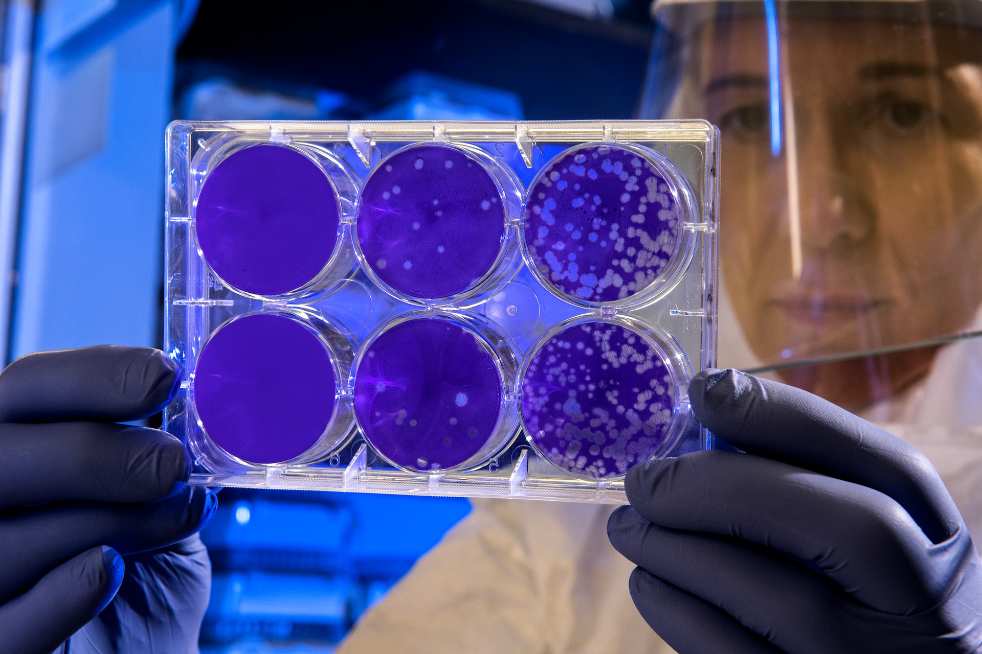 Scientist testing for microorganisms on a petri dish plate