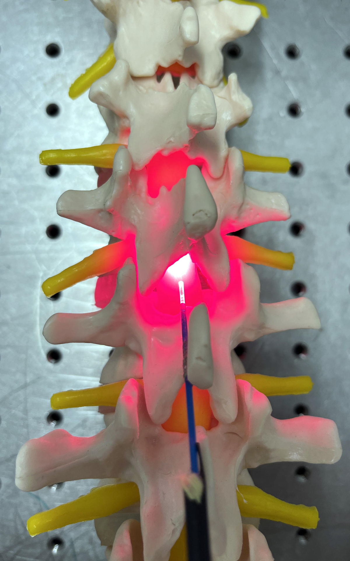 Mock-up of device showing positioning in spinal column