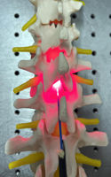 Mock-up of device showing positioning in spinal column