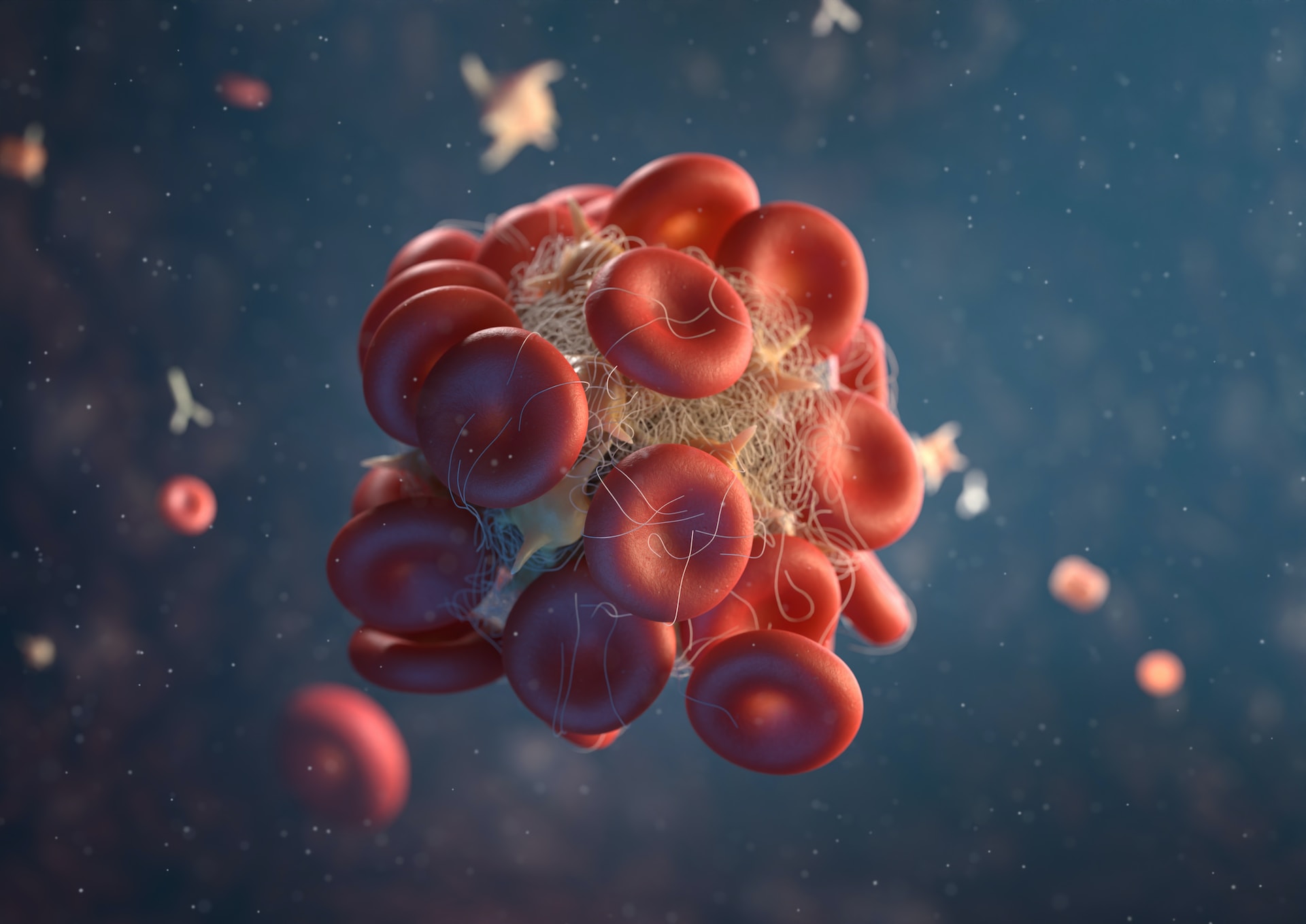 Computer generated image of a thrombus in bloodstream with activated platelets and fibrin