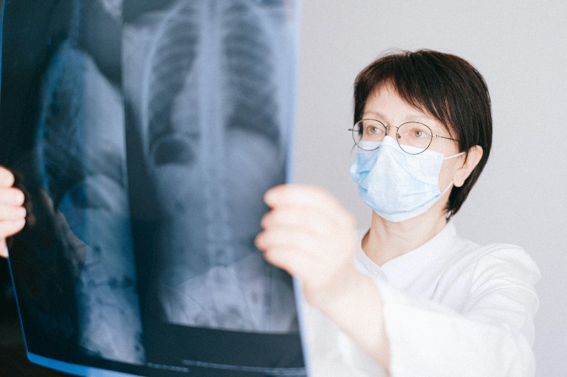 Woman examines lung x-rays