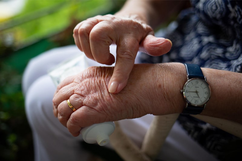 Elderly person pointing at their swollen, arthritic hand