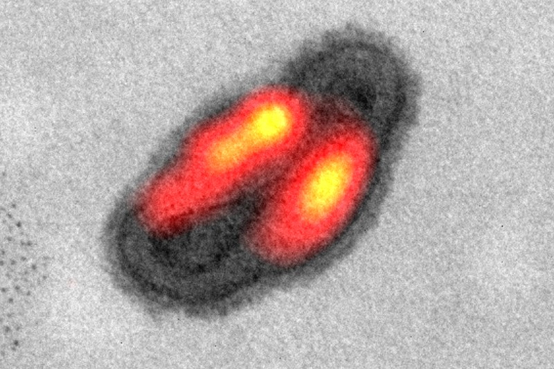 An image of a vaccinia virus with lateral bodies shown in orange